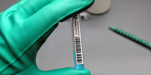 Beitragsbild des Blogbeitrags 7 unterschiedliche „Erkrankungsformen“ bei mildem Covid-19-Verlauf