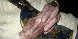 Beitragsbild des Blogbeitrags Morbus Parkinson ist mehr als „Zittern“ – innovative Therapieansätze