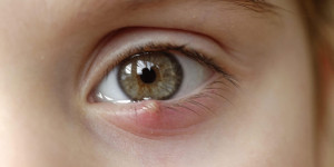 Beitragsbild des Blogbeitrags Gerstenkorn: so wird man die lästige Entzündung am Auge wieder los 