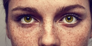 Beitragsbild des Blogbeitrags Frisch und Rein- minimal invasive Behandlungsmethoden für die Haut