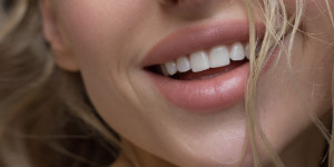 Beitragsbild des Blogbeitrags Der Aufstieg des Lip-Flips und Lip-Lifts: Die neuesten Trends in der plastischen Chirurgie für perfekte Lippen 
