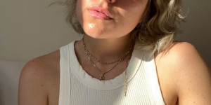 Beitragsbild des Blogbeitrags Skincare Journey: gesunde Haut von innen