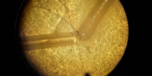 Beitragsbild des Blogbeitrags Zukunft in der Traumatologie