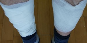 Beitragsbild des Blogbeitrags daham #79: Wundversorgung