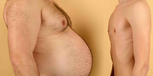 Beitragsbild des Blogbeitrags Aufgedeckt: 3 Mythen zu Mangelernährung