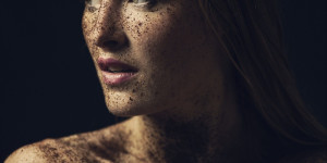 Beitragsbild des Blogbeitrags Unreine Haut - ein leidiges Thema