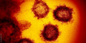 Beitragsbild des Blogbeitrags Warum COVID-19 gefährlicher als die Grippe ist 