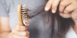 Beitragsbild des Blogbeitrags 10 effektive Tipps gegen Haarausfall, die du noch nicht kennst