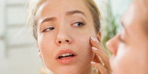 Beitragsbild des Blogbeitrags Die 10 besten Tipps gegen trockene Haut 