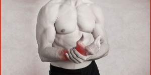 Beitragsbild des Blogbeitrags Sehnenscheidenentzündung durch Sport – Fragen & Antworten