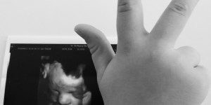 Beitragsbild des Blogbeitrags Und… wann kommt das Dritte? Eine nicht übliche Frage.