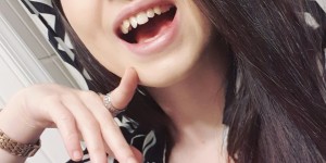 Beitragsbild des Blogbeitrags Being bullied and the story of my teeth