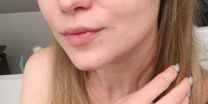 Beitragsbild des Blogbeitrags Ulthera: Die Beauty-Behandlung im Test