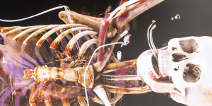 Beitragsbild des Blogbeitrags Jury ehrt Anatomieunterricht der Zukunft