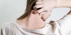 Beitragsbild des Blogbeitrags Psoriasis: Healthy Habits