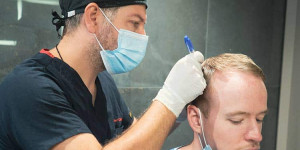 Beitragsbild des Blogbeitrags First Hair Clinic – Ihre Premium-Haartransplantation in Frankfurt am Main
