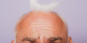 Beitragsbild des Blogbeitrags Hormonell bedingter Haarausfall – Ursachen und Behandlungsmöglichkeiten 