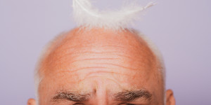 Beitragsbild des Blogbeitrags Hormonell bedingter Haarausfall – Ursachen und Behandlungsmöglichkeiten