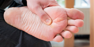 Beitragsbild des Blogbeitrags Hühnerauge: Ursachen, Symptome und Behandlung