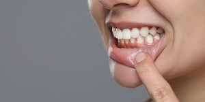 Beitragsbild des Blogbeitrags Parodontitis: Symptome und ihre Rolle beim Zahnfleischrückgang 