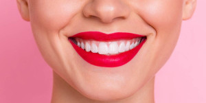 Beitragsbild des Blogbeitrags #Mundgesundheit: Gesundes Zahnfleisch steht dir gut! Schütze es! 