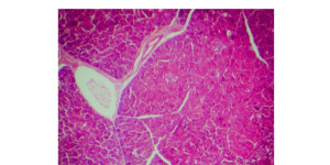 Beitragsbild des Blogbeitrags Studie: Antidiabetische Wirkung von Ginseng-Extrakt