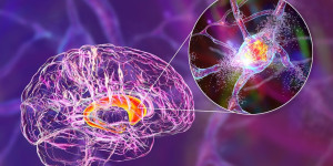 Beitragsbild des Blogbeitrags Erforschung neuer therapeutischer Ziele und Biomarker für neurodegenerative Erkrankungen 
