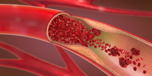 Beitragsbild des Blogbeitrags Forscher stellen ein nicht poröses, biologisch abbaubares Gefäßtransplantat her