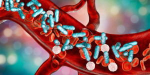 Beitragsbild des Blogbeitrags Die Kombination von Genexpressionsprofilen des Wirts und dem Nachweis metagenomischer Krankheitserreger aus Plasma-Nukleinsäure ermöglicht eine genaue Sepsis-Diagnose