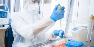 Beitragsbild des Blogbeitrags Analysen von 11 kommerziell erhältlichen PCR-Kits zum Nachweis von Affenpockenvirus-DNA 