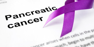 Beitragsbild des Blogbeitrags Biomedizinische Ingenieure von Duke entwickeln einen zweigleisigen Ansatz zur Behandlung von Bauchspeicheldrüsenkrebs 