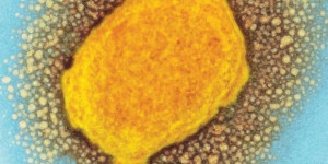 Beitragsbild des Blogbeitrags Die Standorte von Mass General Brigham geben ihre Teilnahme an der Phase-3-Studie zur Behandlung von Affenpocken bekannt