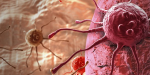 Beitragsbild des Blogbeitrags Die genetische Signatur sagt Tumormetastasen und das Überleben des Patienten bei klarzelligem Nierenkrebs voraus 