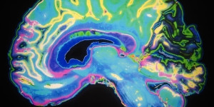 Beitragsbild des Blogbeitrags Studie zeigt, dass die Struktur der unregelmäßigen neuronalen Verbindungsstärken eine verborgene Ordnung enthält 