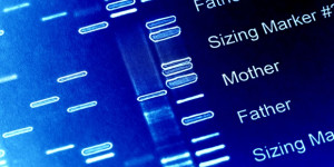 Beitragsbild des Blogbeitrags Zink könnte die durch eine seltene genetische Störung verursachten Hirnschäden lindern