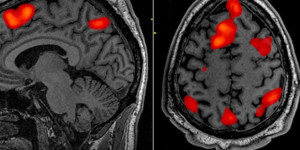 Beitragsbild des Blogbeitrags Forscher erhalten einen NIH-Zuschuss in Höhe von 3,4 Millionen US-Dollar, um die Kompromisse des Fußballs in Bezug auf die Gehirngesundheit zu bewerten