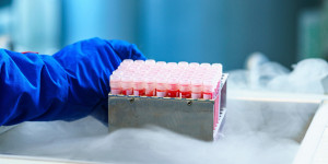 Beitragsbild des Blogbeitrags Welche Wirksamkeit haben RT-PCR-Assays zum Nachweis von SARS-CoV-2 im menschlichen Sperma? 