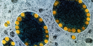 Beitragsbild des Blogbeitrags Wissenschaftler entwickeln Organoide menschlicher Speicheldrüsen, um die Infektiosität von SARS-CoV-2 zu testen