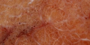 Beitragsbild des Blogbeitrags Schilddrüse – natürliche Wege der Heilung