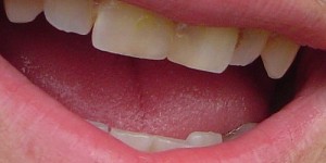 Beitragsbild des Blogbeitrags Die Sprache der Zähne – natürliche Wege der Stärkung und Heilung