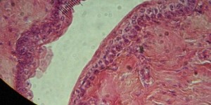 Beitragsbild des Blogbeitrags Blasenentzündung mit natürlichen Mitteln heilen