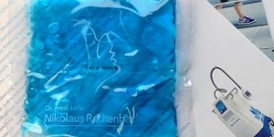 Beitragsbild des Blogbeitrags Meine Coolsculpting Erfahrung – das Fett am Oberschenkel soll weg!