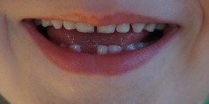 Beitragsbild des Blogbeitrags So funktioniert das mit der Zahnfee … garantiert nicht. Ein Rant.