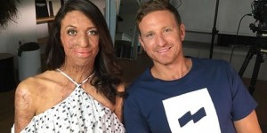 Beitragsbild des Blogbeitrags Vor 6 Jahren bei einem Ultramarathon fast verbrennt - nun ist Turia Pitt schwanger! 