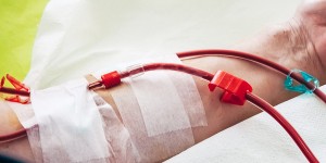 Beitragsbild des Blogbeitrags Niereninsuffizienz – Ursachen, Symptome, Stadien, Krankheitsverlauf, Behandlung